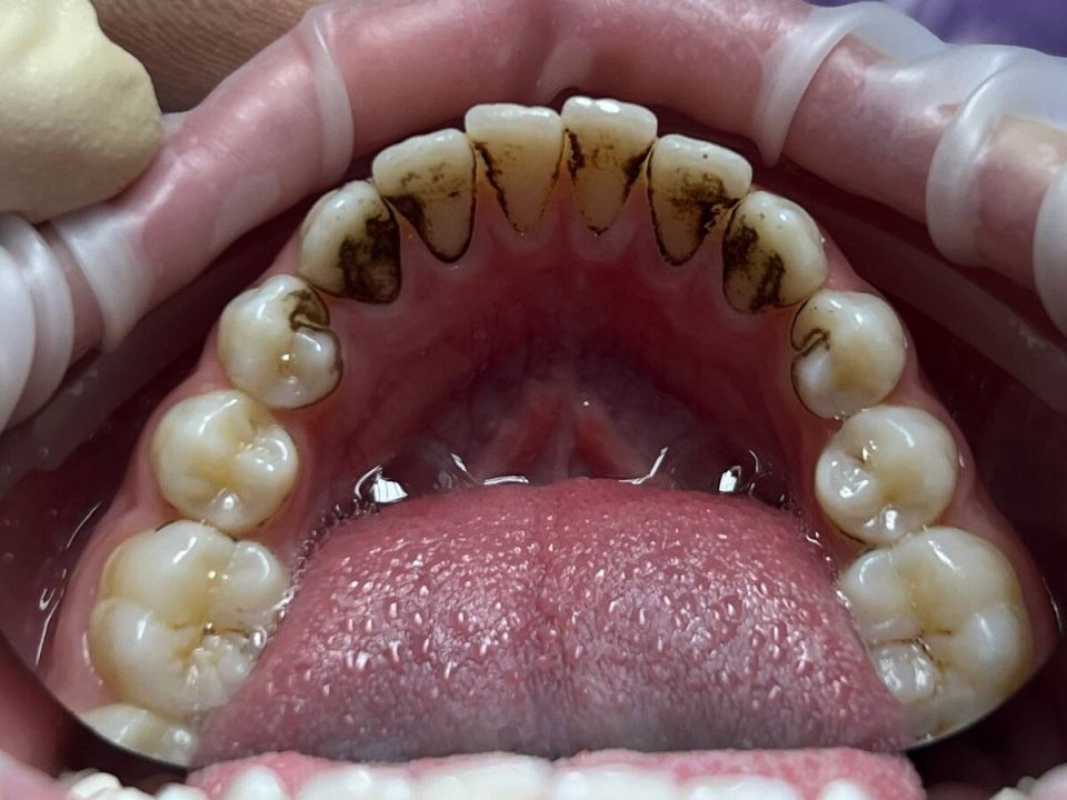    :        ?