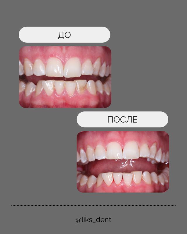 ������ ����� �������� �������� �� ���������������� ������ �����