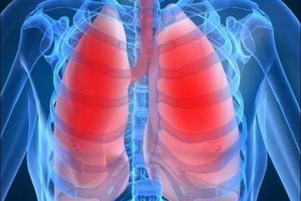 ����������� �������� ������ ��� ������� ���������: 17 ����������� ��������