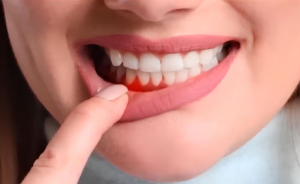 Как правильно ухаживать за зубами после профессиональной чистки: советы стоматолога