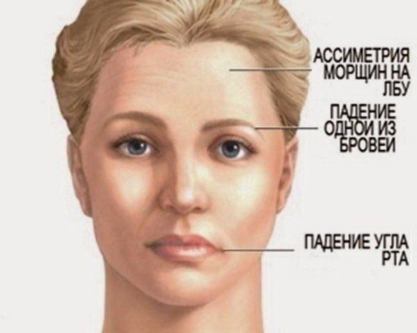 �������� ��������: ��� ����������� � ����������� ������